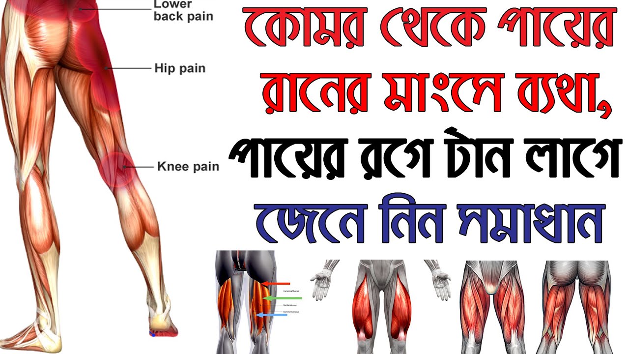 কোমর থেকে পায়ের রানের মাংসে ব্যথা, পায়ের রগে রান লাগে! জেনে নিন সঠিক সমাধান