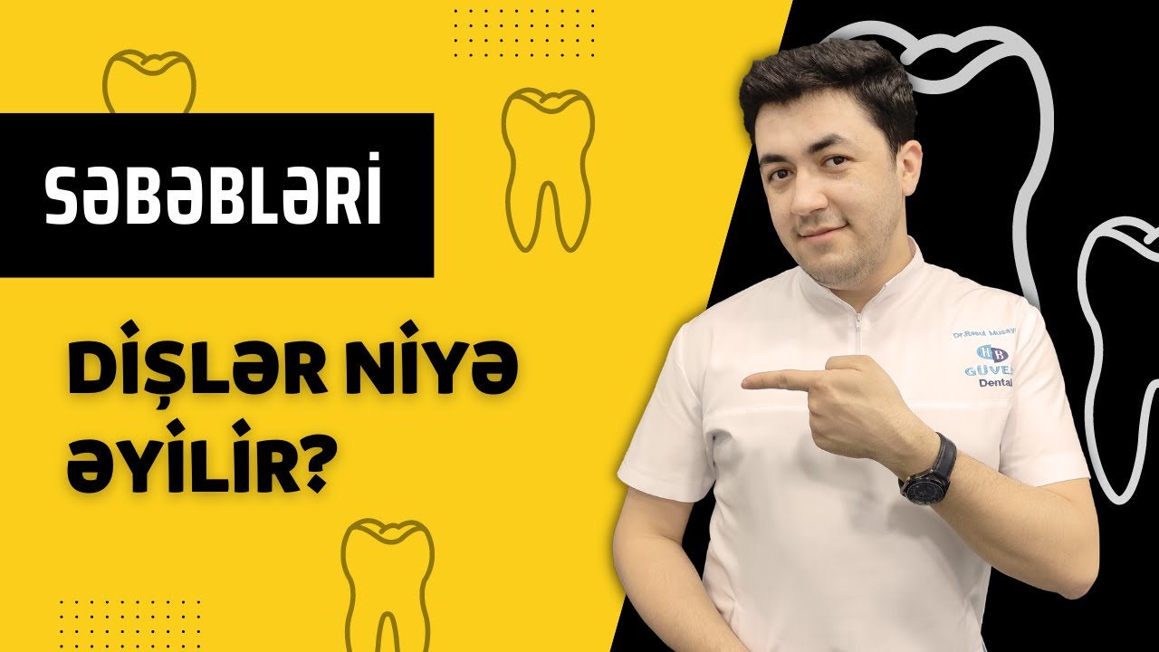 Dişlər niyə əyilir ? | Diş məsələsi #3 #dismeselesi