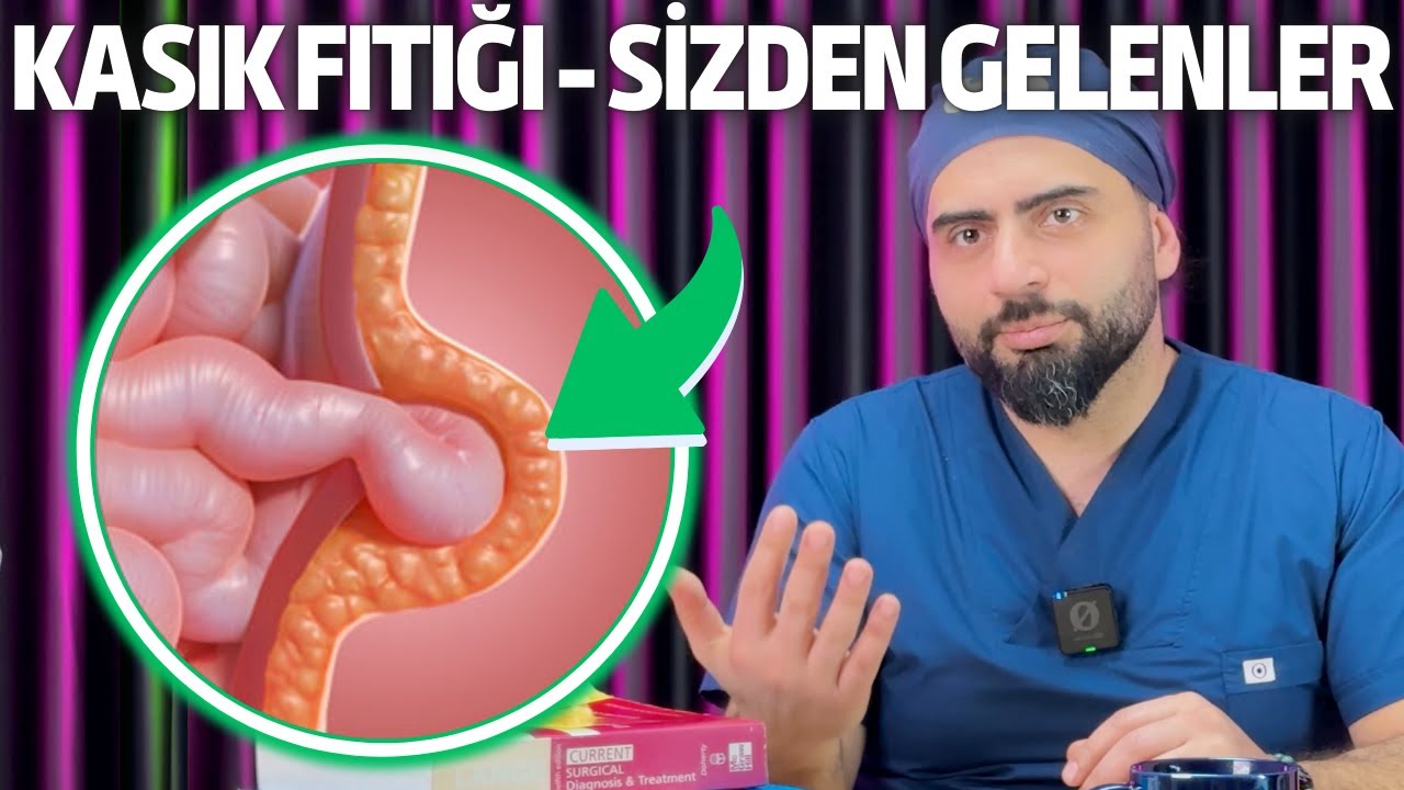KASIK FITIĞI AMELİYATI SİZDEN GELENLERİ CEVAPLADIK - DR. AHMET BEKİN YANITLIYOR