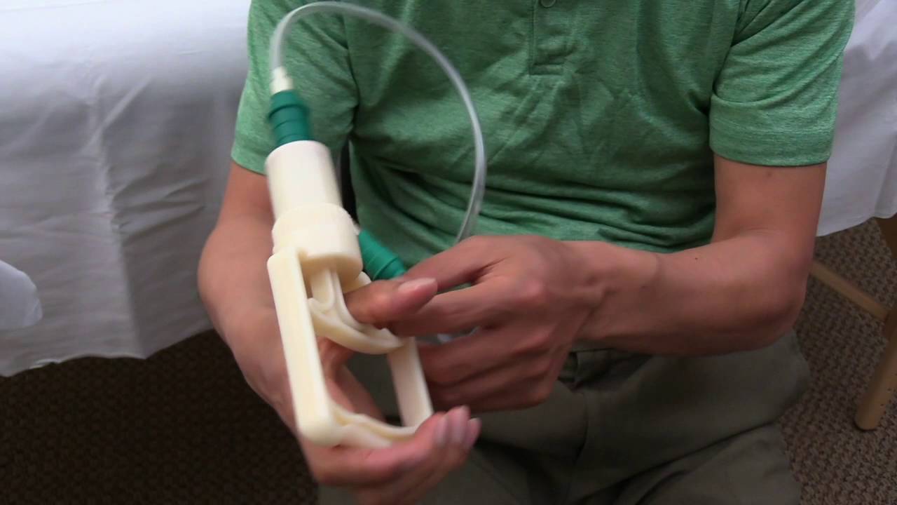 Chinese Cupping Therapy to Relieve Elbow Pain at Home