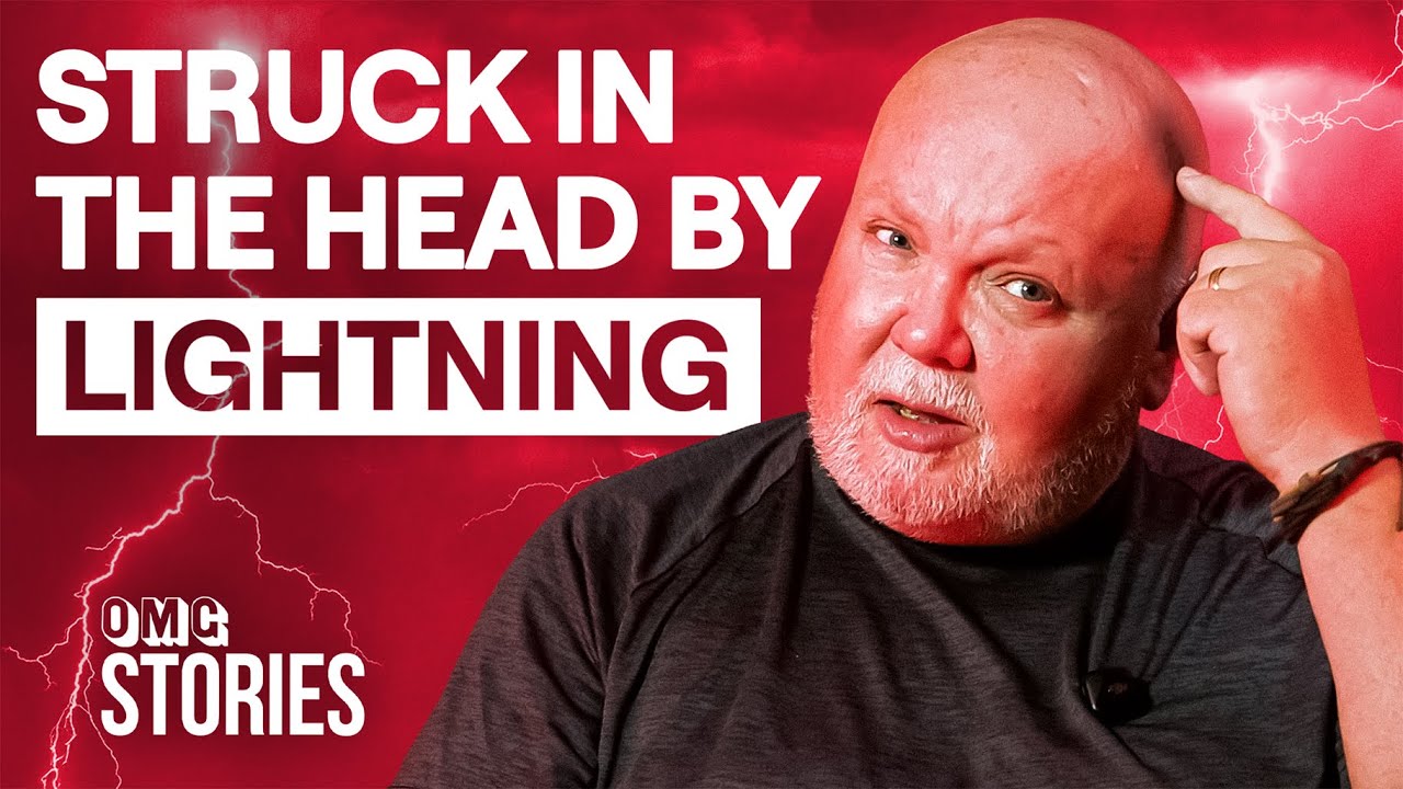 I Survived Being Struck In The Head By Lightning | OMG Stories