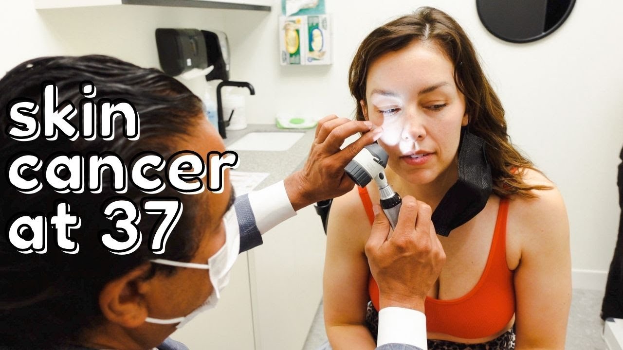 Skin Cancer Prevention with Mole Mapping using Fotofinder