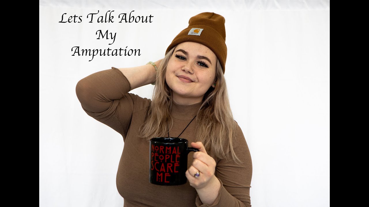 Story time: Why I got an amputation