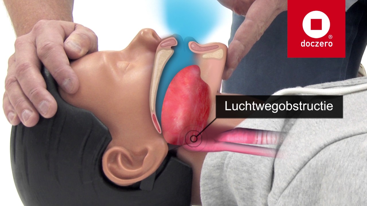 Basale reanimatie | Doczero E-learning