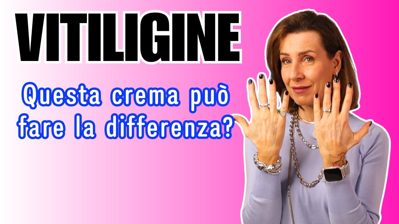 Ho provato la crema innovativa per la Vitiligine: ecco cosa è davvero cambiato