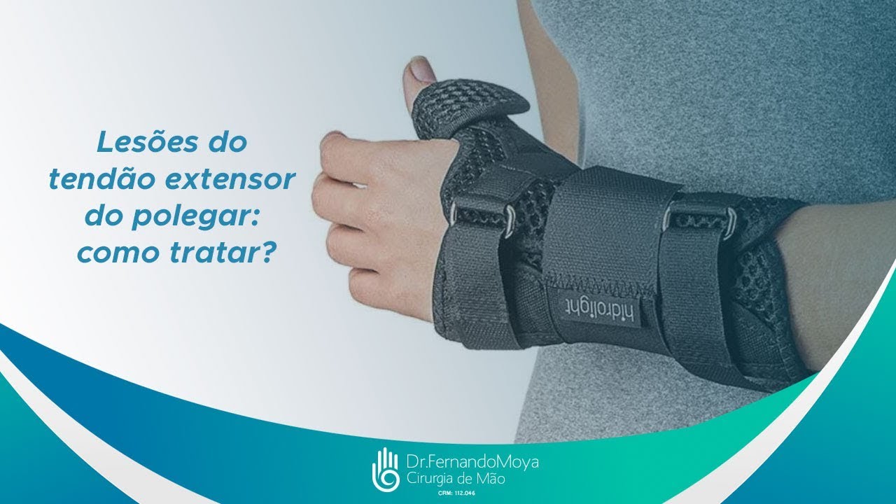 Lesão do tendão extensor do polegar: como tratar? | Dr. Fernando Moya CRM 112046