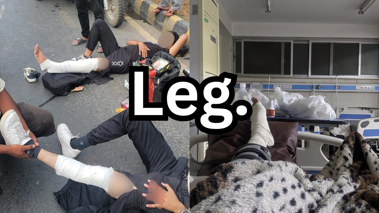 How I Broke my Leg, Nearly Died and Recovery as a Muslim on self improvement…(Urdu)