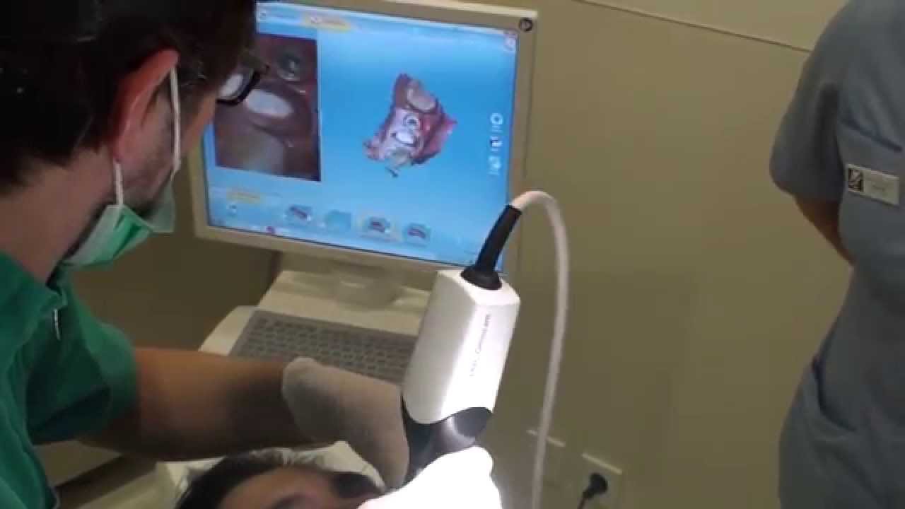 Sistema Cerec Cad-Cam - Omnicam. Implante + Dente. Est&eacute;tica Dent&aacute;ria / Pr&oacute;tese Fixa