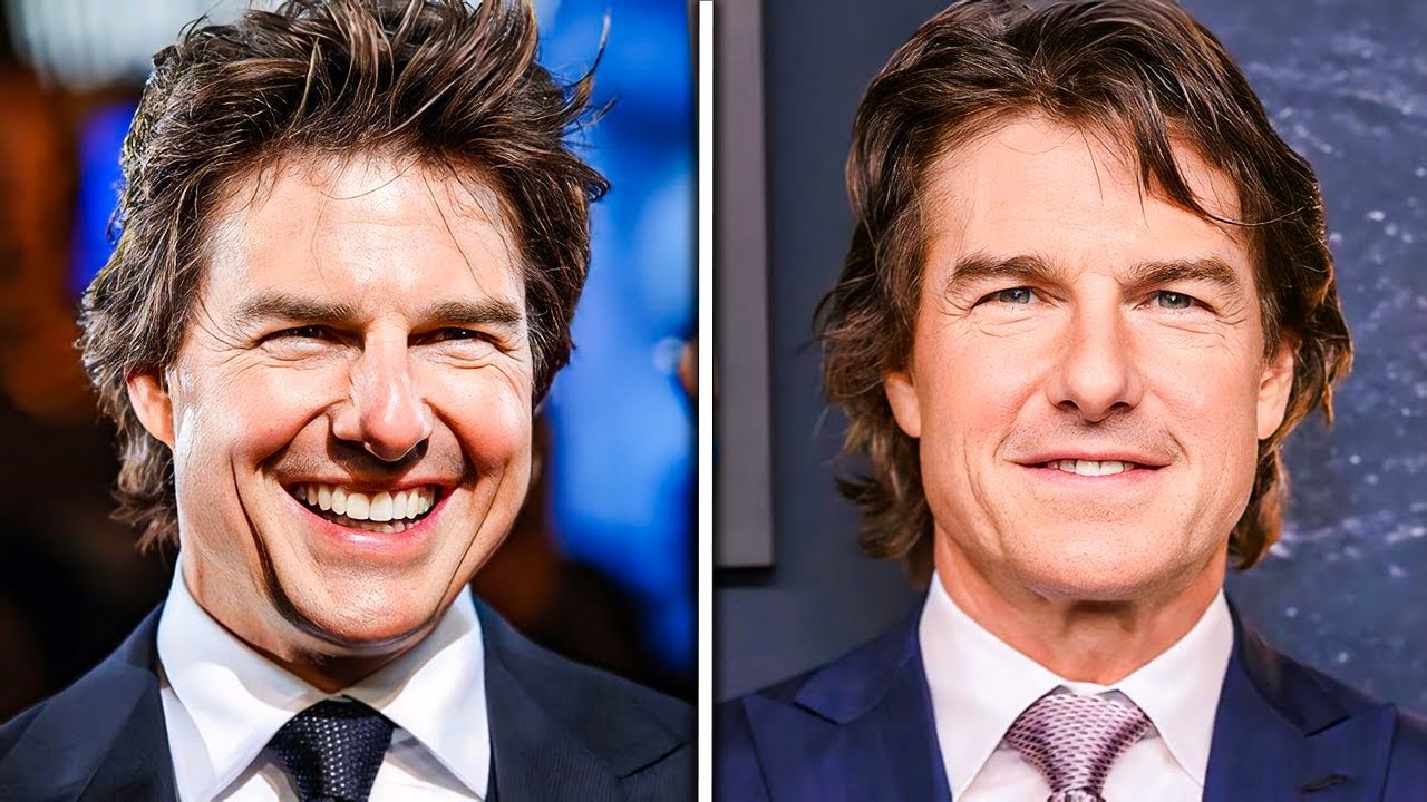 Did Tom Cruise Get Plastic Surgery On His Face?!