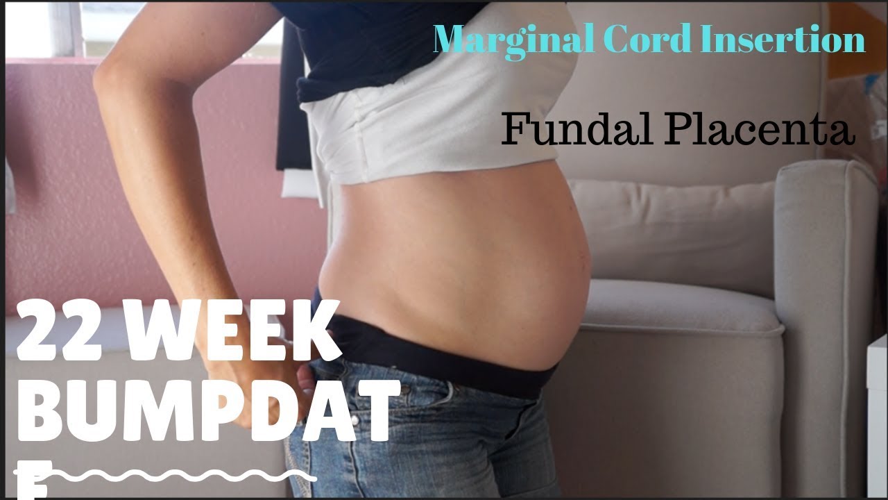 22 WEEKS  BUMPDATE| MARGINAL CORD|FUNDAL PLACENTA