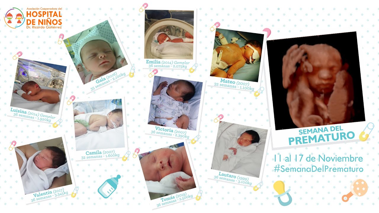 Día Mundial del Niño Prematuro: la fragilidad de nacer antes de tiempo