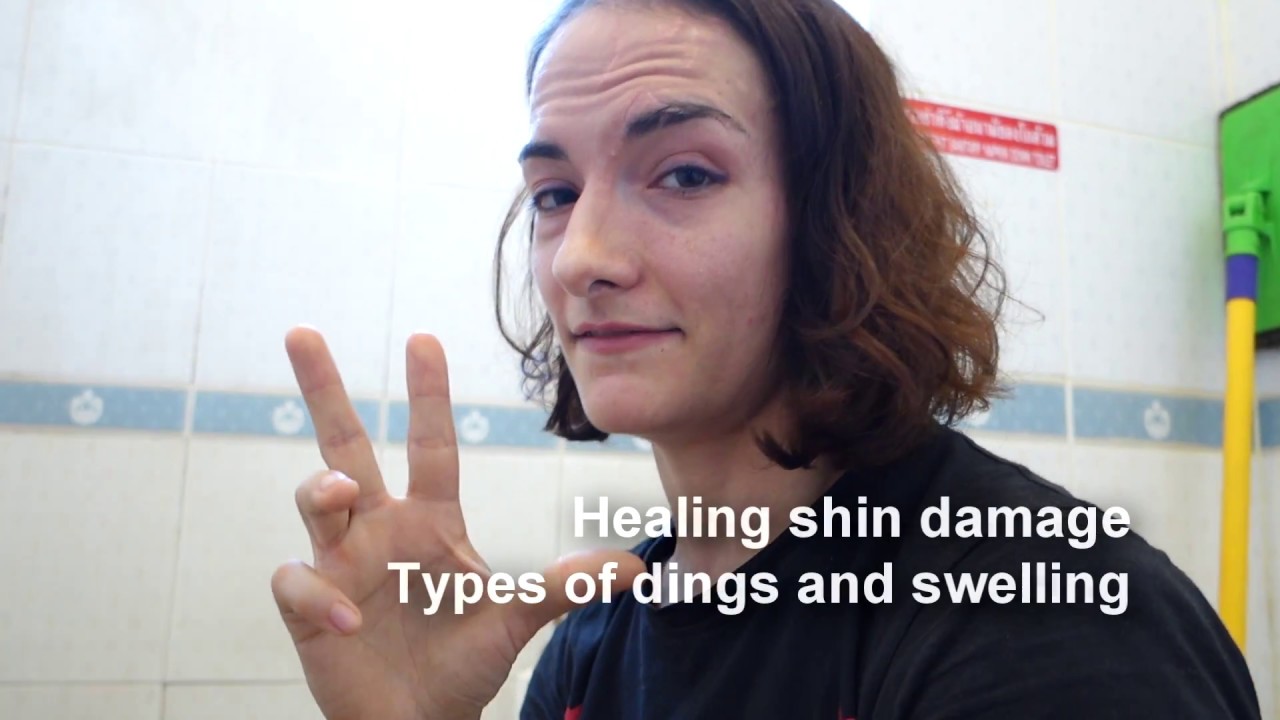 Treating Shins for Muay Thai Damage - Dents, Dings and Bumps