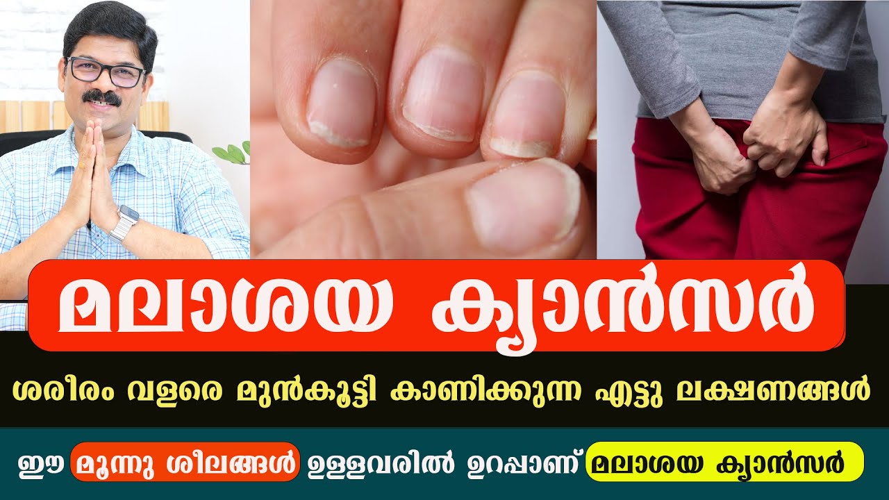 ഈ മൂന്നു ശീലങ്ങൾ ഉള്ളവരിൽ ഉറപ്പാണ് മലാശയ ക്യാൻസർ ആദ്യ ലക്ഷണങ്ങൾ അവഗണിക്കരുത്  / Dr Shimji