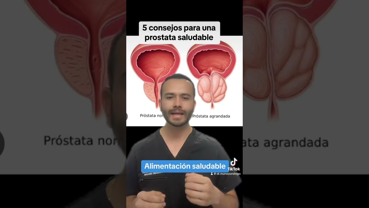 Consejos para una prostata sana / ur&oacute;logo tijuana