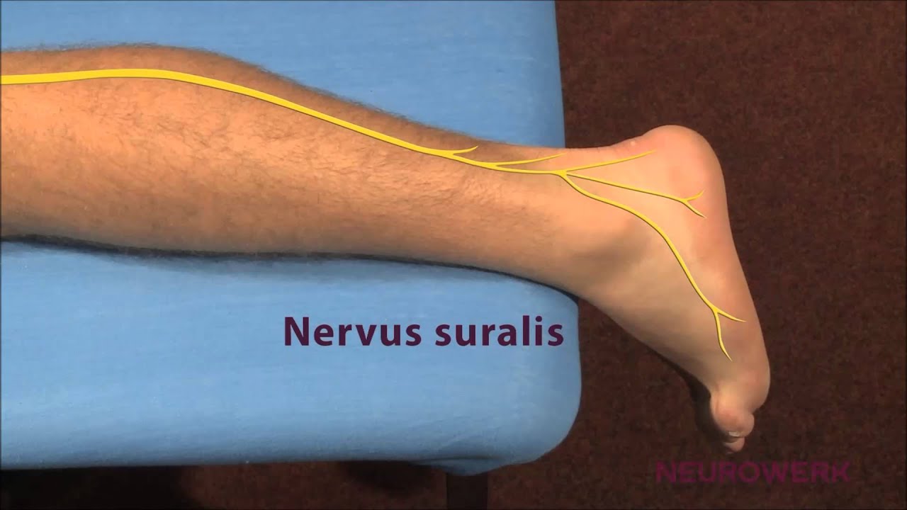 Sensible Neurographie - Suralis