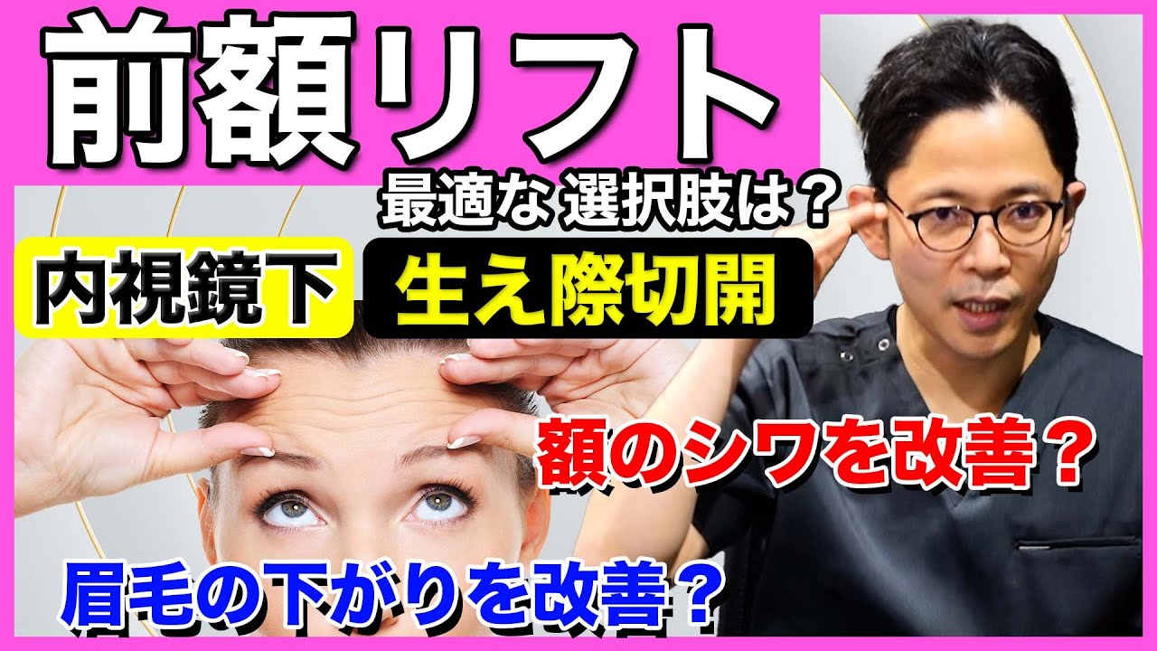 前額リフト治療法の選び方
