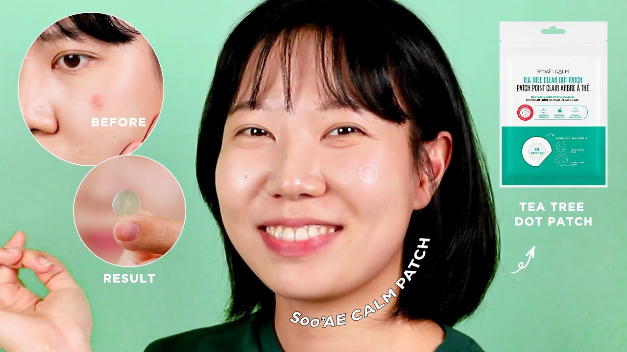 Soo'AE Calm : Tea Tree Clear &ndash; Dot Patch