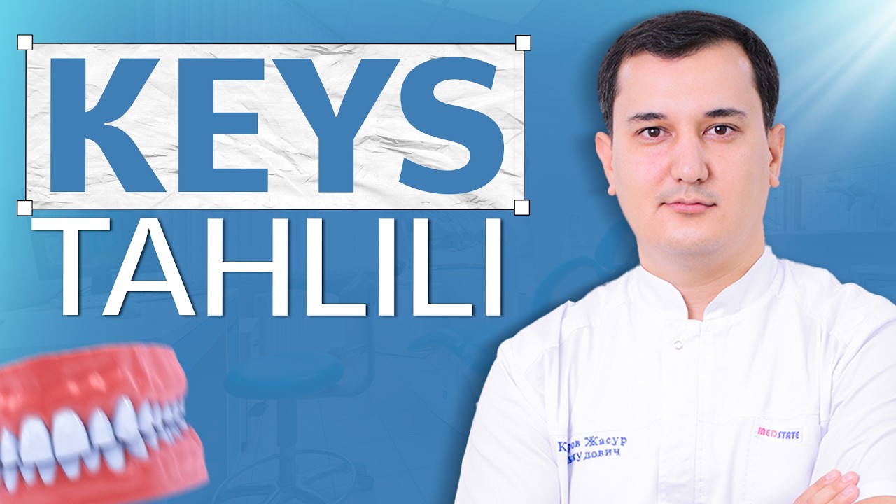 Notekis tishlarni breketsiz to'g'irlash | Keys tahlili