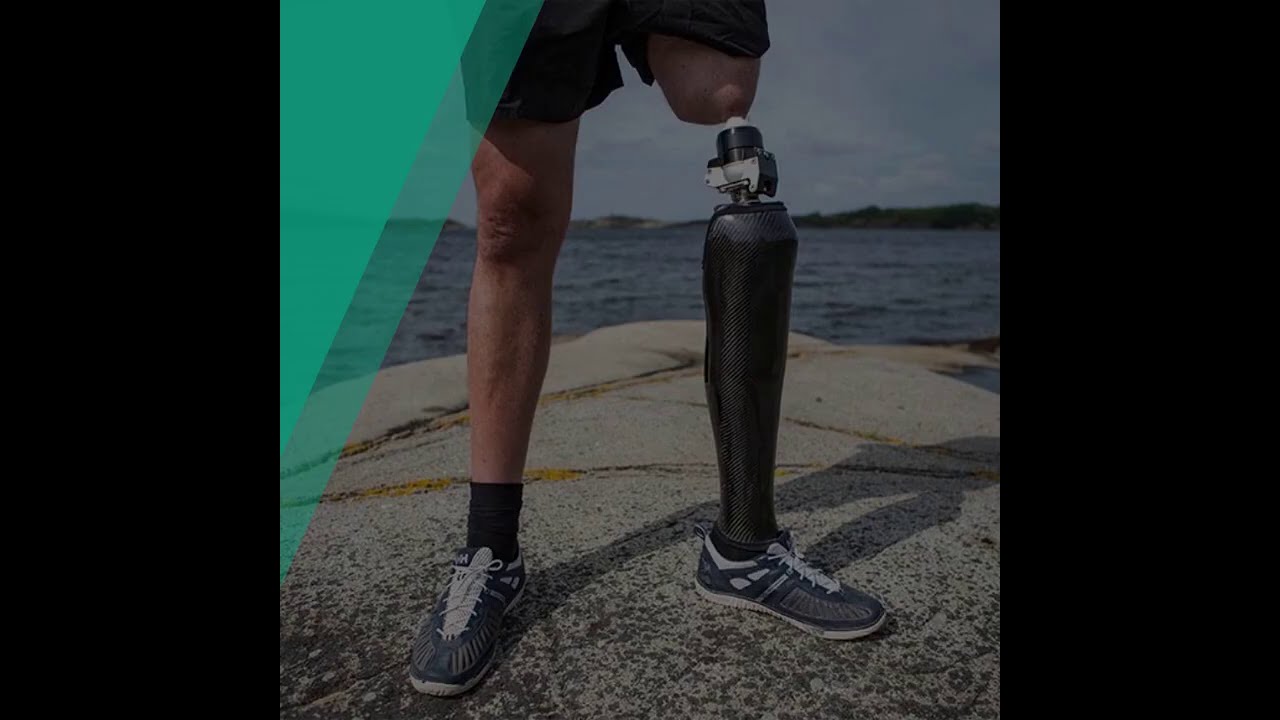 Interview with Surgeons at the Osseointegration Program at St  Luke's Medical Center