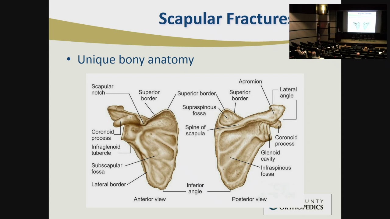 Clavicle and Scapula Fractures - Stephen Hunt, MD