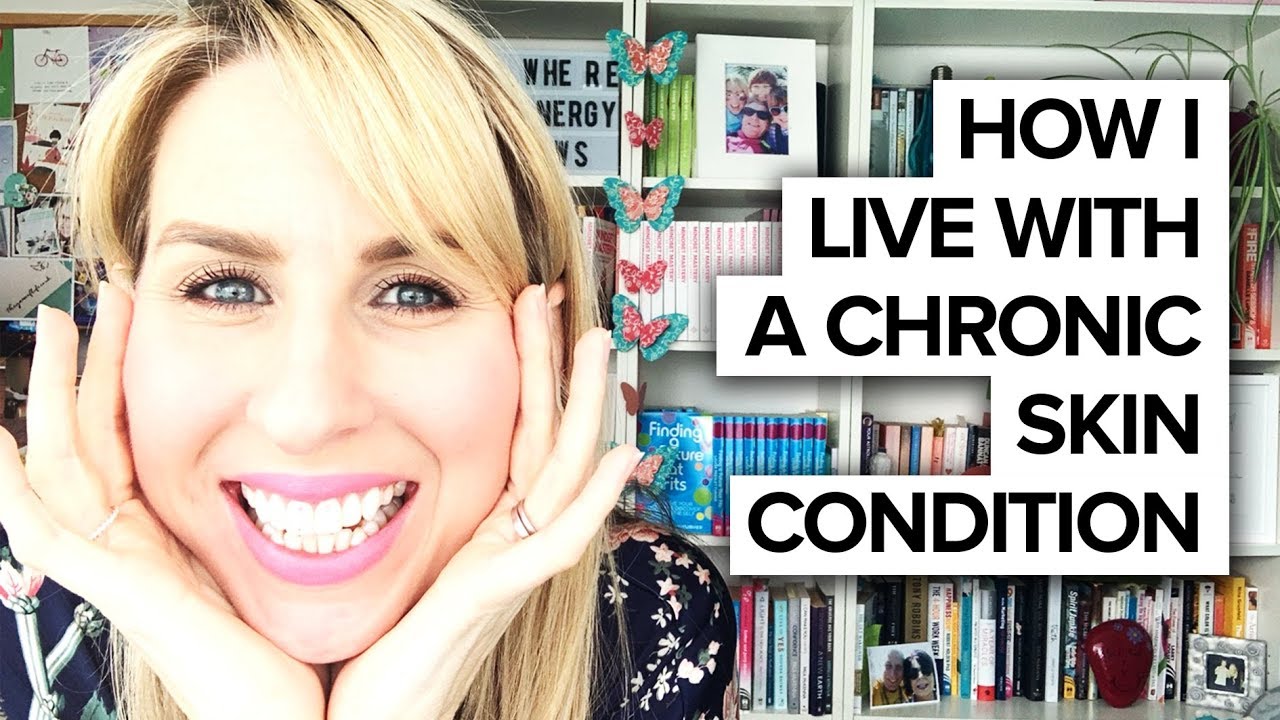 Living with a chronic skin condition