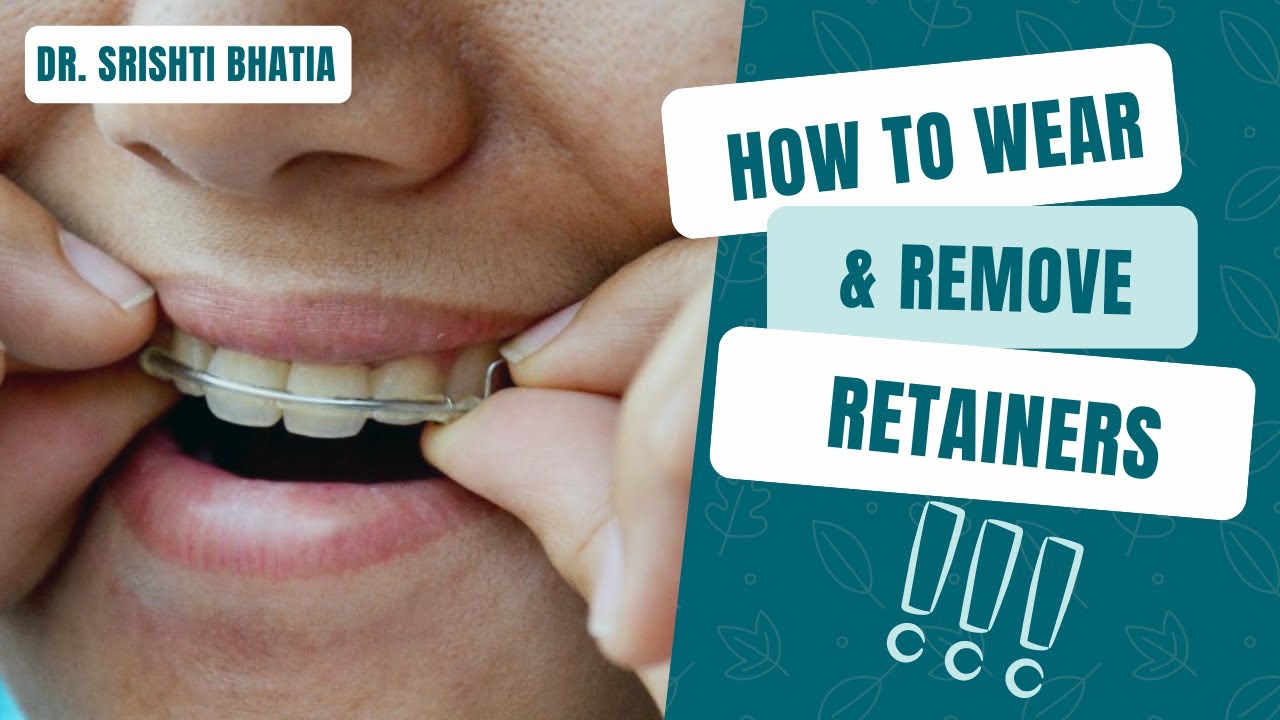 HOW TO WEAR AND REMOVE RETAINERS AFTER BRACES (hindi)? Dr. Srishti Bhatia