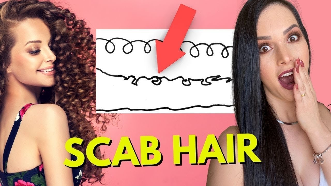 SCAB HAIR: O Que &eacute; e Como Tratar o Scab Hair em 5 passos!
