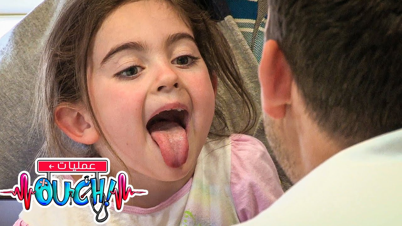 (أوبريشن آوتش) - كيف تُصنع الجبائر الجصّية؟ | العلوم للأطفال