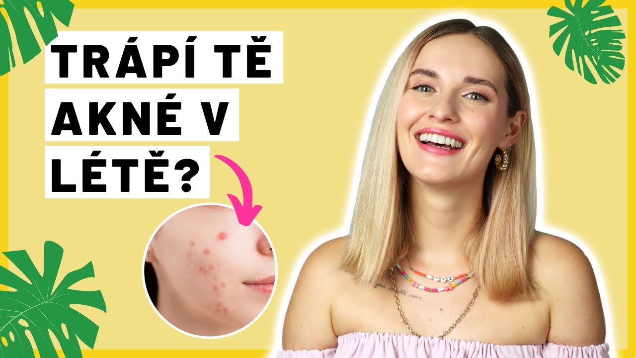 5 tipů na péči o aknózní pleť v létě