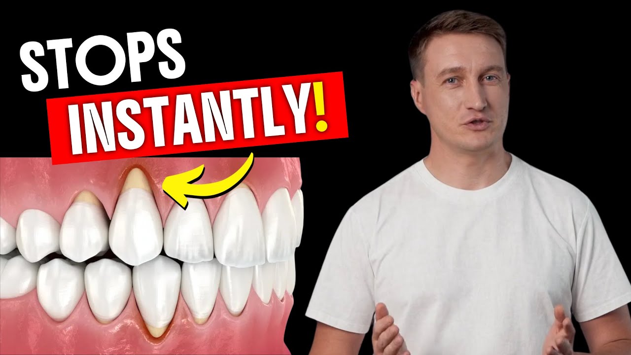 2 KILLER Tips to (COMPLETELY ELIMINATE) Gum Recession! | Dentist Explains