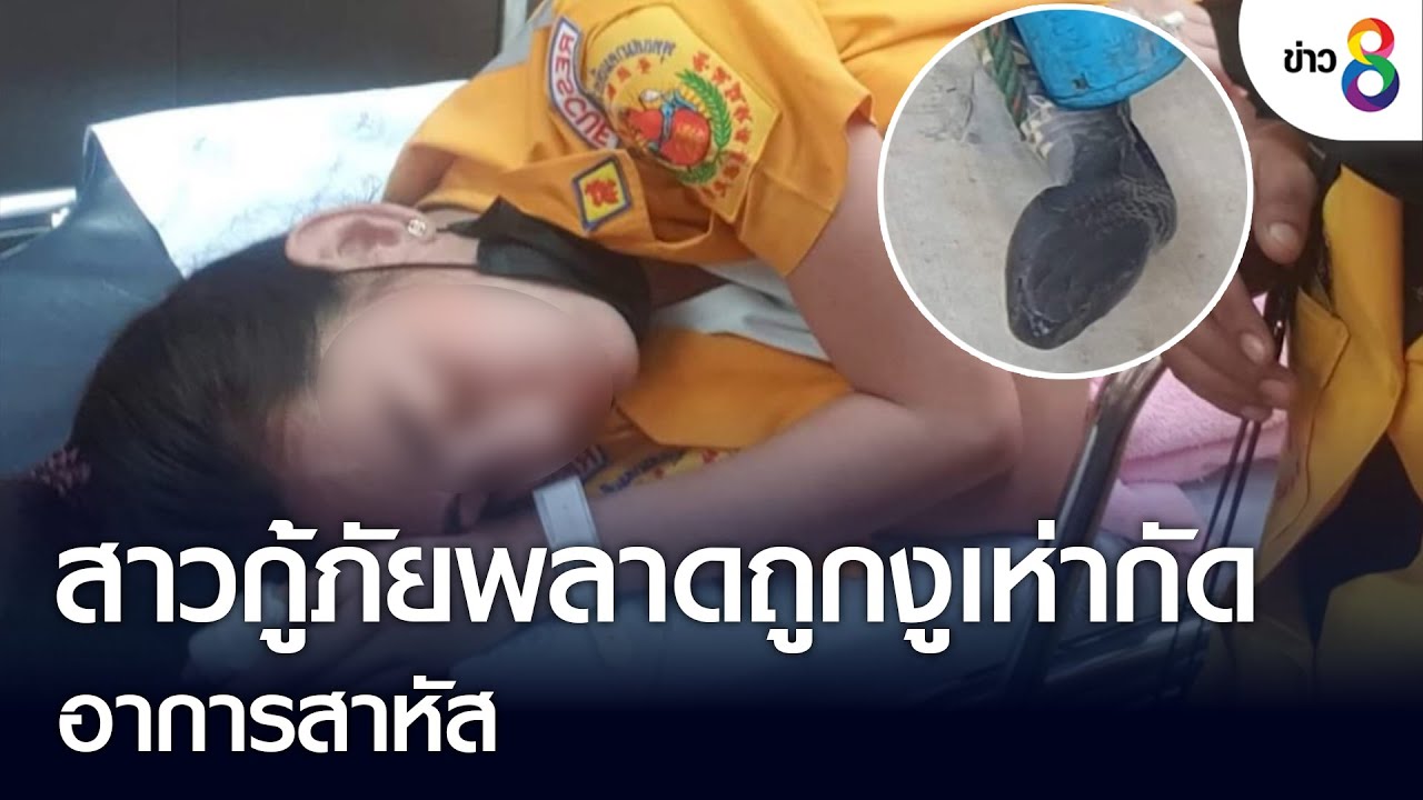 สาวกู้ภัยพลาดถูกงูเห่ากัด อาการสาหัส | ข่าวช่อง 8 | 18 ส.ค. 65