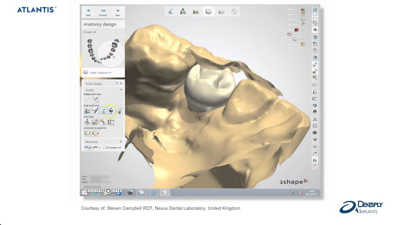 Atlantis™ abutments− Atlantis abutment Core File | Dentsply Sirona