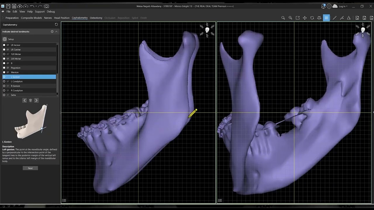 Materialize mimics Enlight workflow  