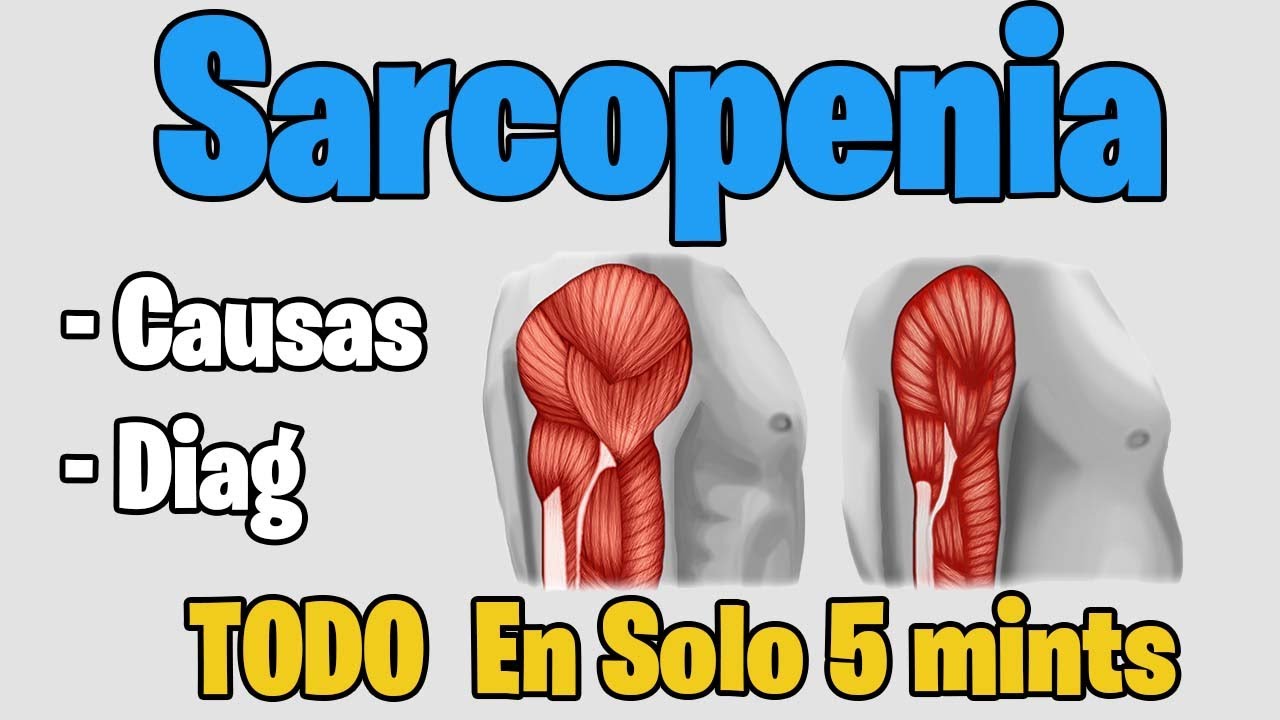 SARCOPENIA | Conoce los sintomas y TRATAMIENTO | perdida de masa muscular