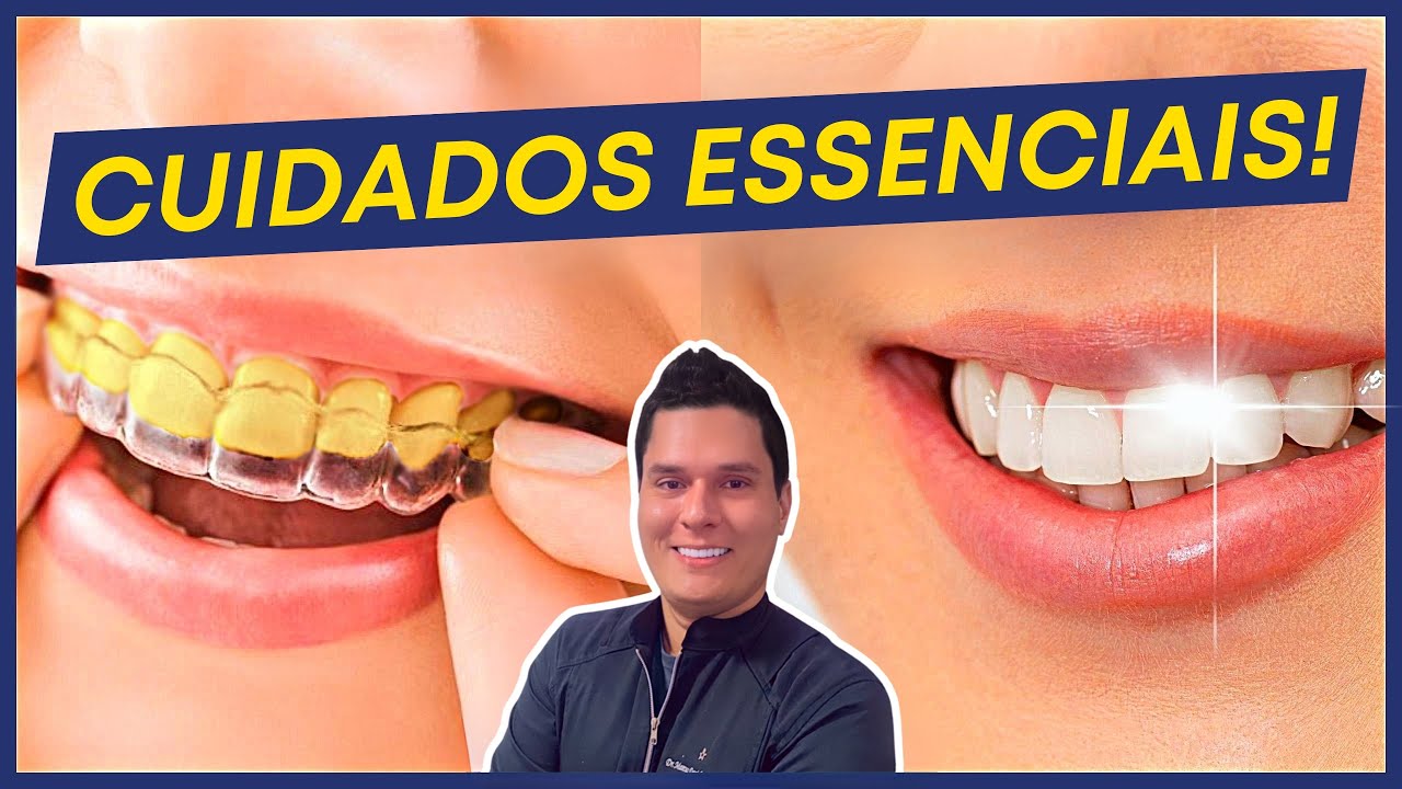CLAREAMENTO DENTÁRIO CASEIRO: 10 Cuidados ESSENCIAIS para um SORRISO BRANCO de VERDADE!