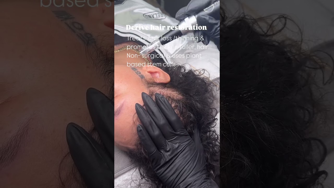 Derive Hair Restoration System