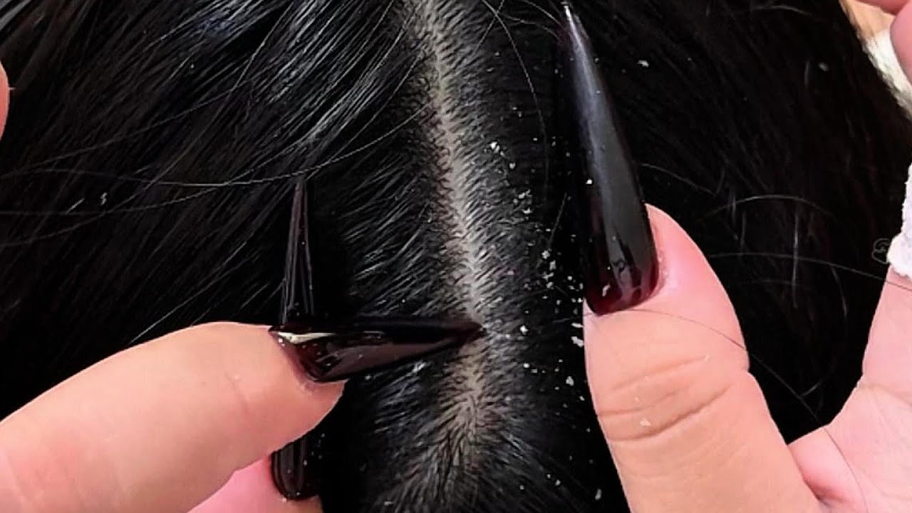 Sleep ASMR 🌙 | Gentle Scalp Relaxation with Nails | Model: Cola