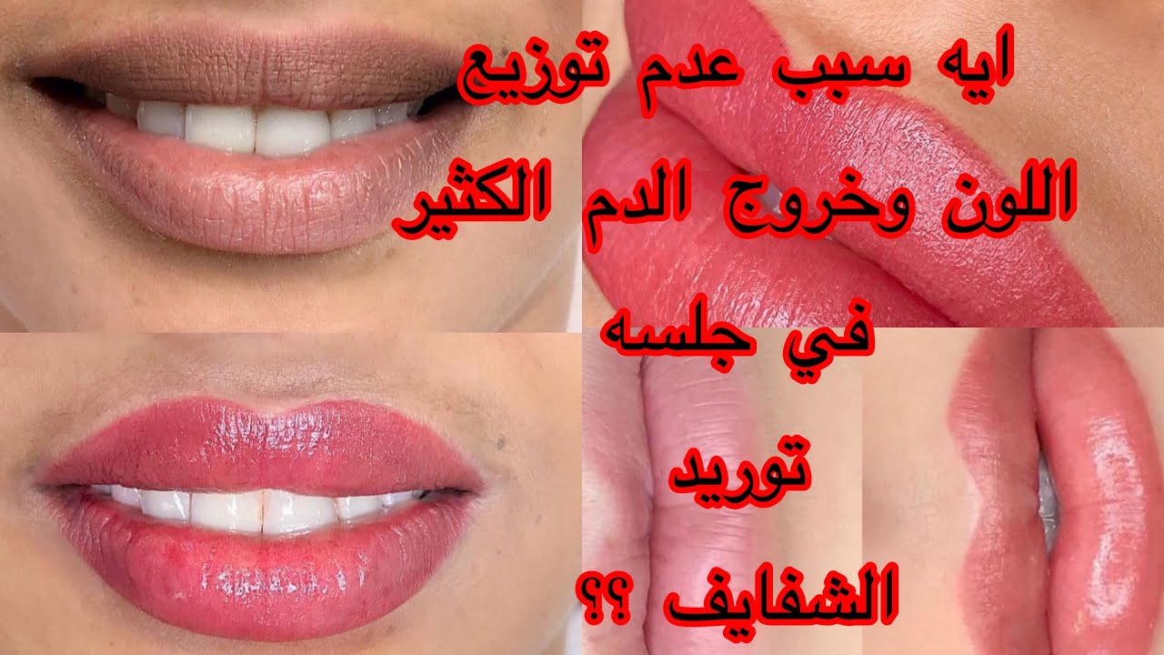 سبب عدم ثبات وتوزيع اللون ونزول الدم اثناء جلسه التوريد الشفايف (وايه افضل ماركه لون للتوريد)