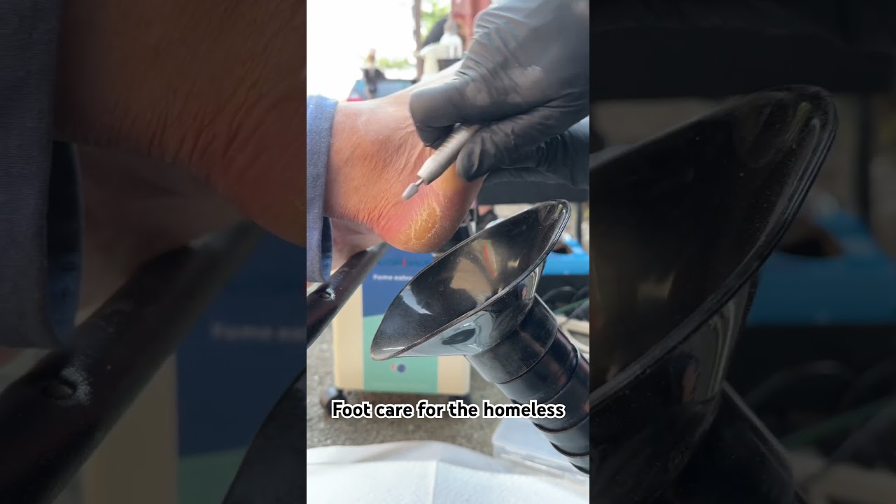 Callus removal at The Bridge in Columbus, OH #nailtech #pedicure #callus #shorts #foot