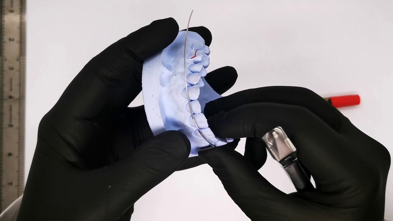 4th stage  9th  orthodontic lab Labial Arch