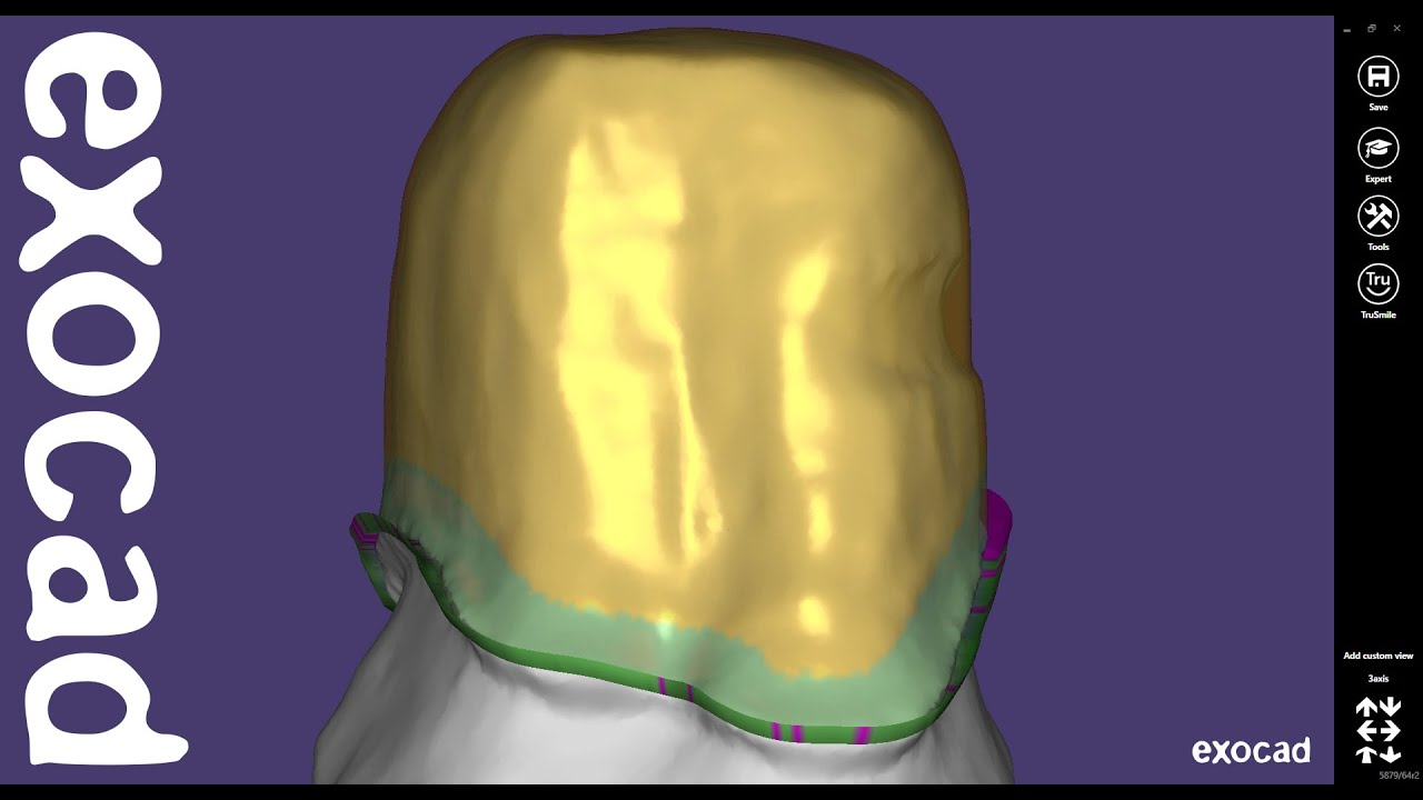 exocad Quick Guide: Crown Bottoms
