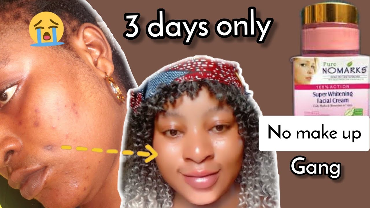 #facecream || Bëst LIGHTENING FACE Cream 2022 !!  No Marks Face cream|No Marks Face Cream Review