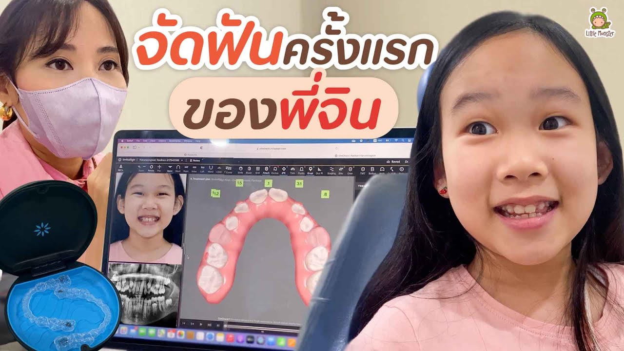 จัดฟันครั้งแรกของพี่จิน จะเจ็บไหมนะ ? | Little Monster