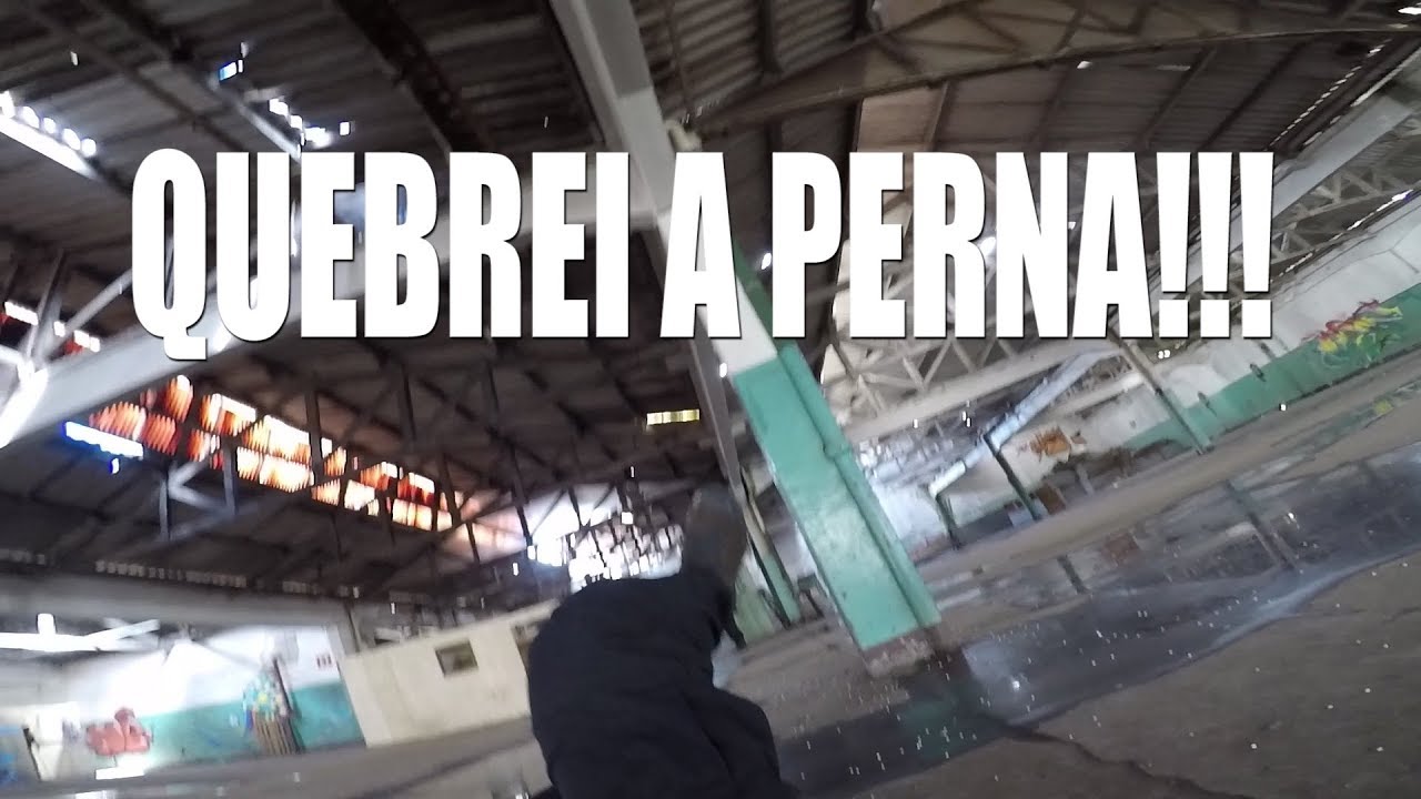 QUEBREI A PERNA JOGANDO AIRSOFT: O PIOR DIA DA MINHA VIDA