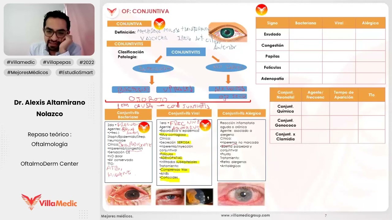 CONJUNTIVITIS - OFTALMOLOGÍA - VILLAMEDIC