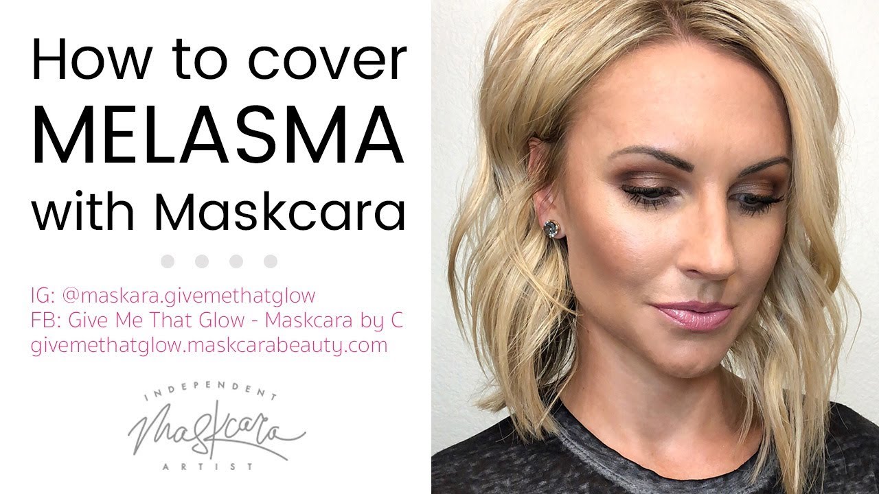 Covering Melasma w/ Maskcara Makeup