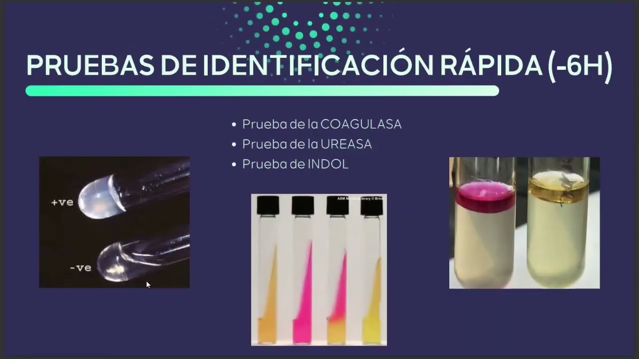 Pruebas Bioquímicas - Microbiología 2023