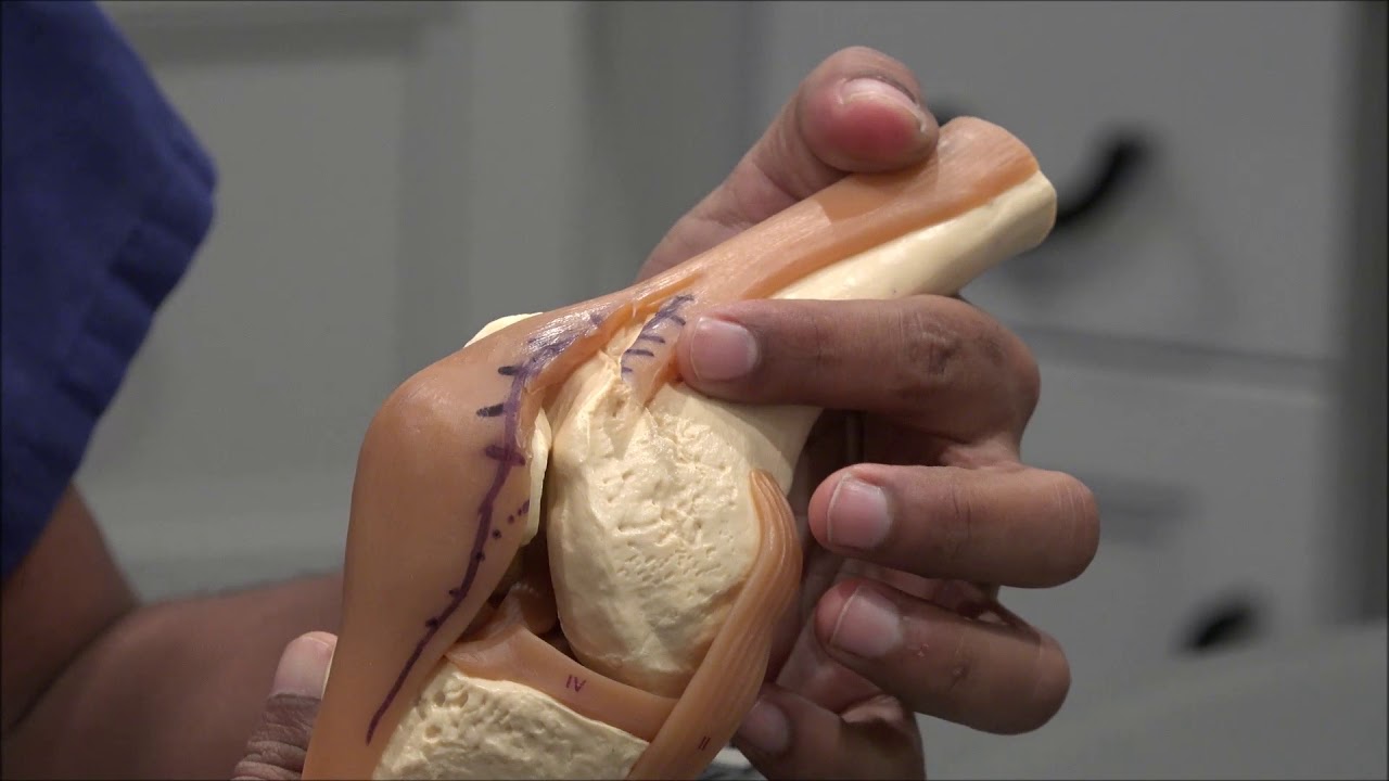 Dr. Manish Patel explains the Jiffy Knee vs. how other surgeons do the surgery.