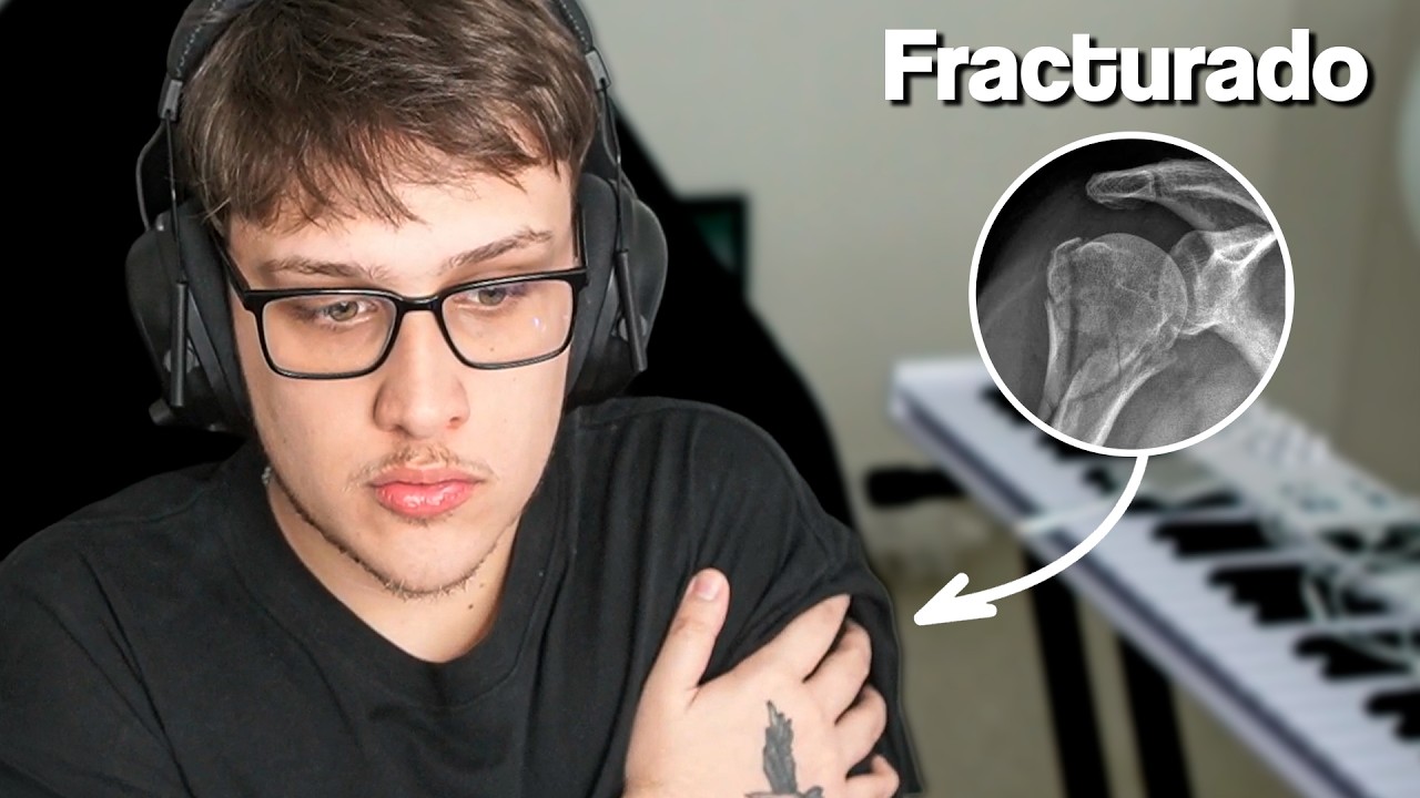 Me fractur&eacute; el brazo | Chillin con Pablots