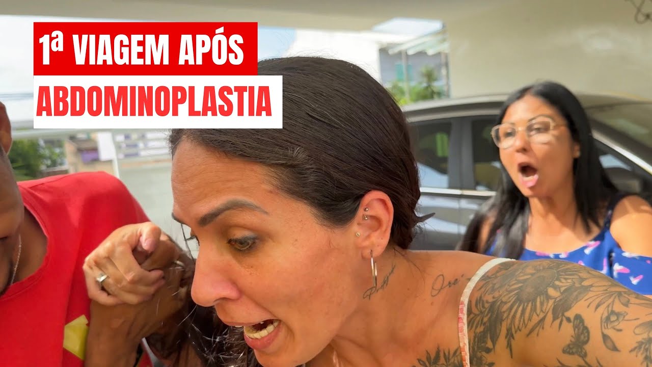 PRIMEIRA VIAGEM APÓS ABDOMINOPLASTIA  E RETIRADA DE APARELHOS 